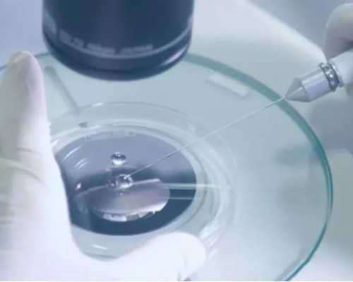 国内地下供卵费用,广东的试管多少钱，具体花费看这3大部分