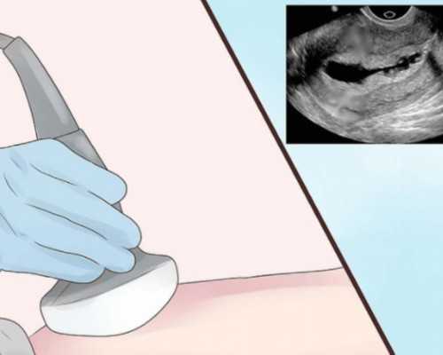 中国供卵中心有哪些城市,[家的温馨]贵阳染色体缺失做试管可以助孕